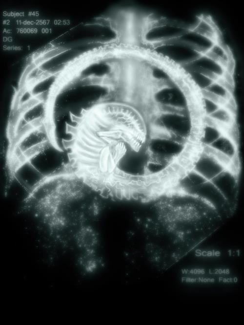 CationthisAlienxray